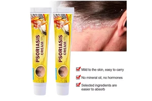 牛皮癬軟膏中藥皮炎濕疹軟膏瘙癢性皮炎軟膏中藥止癢軟膏